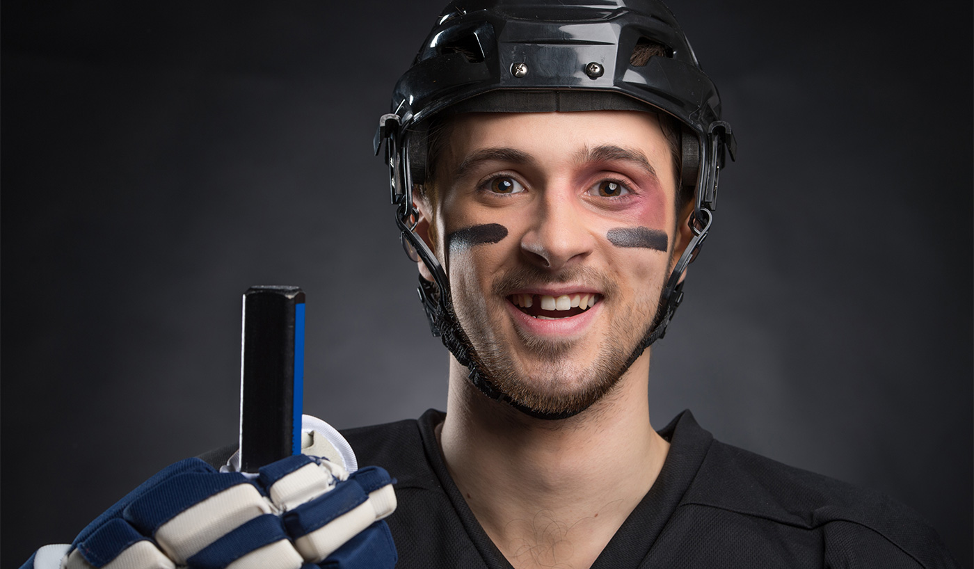 Dental Sports Injuries