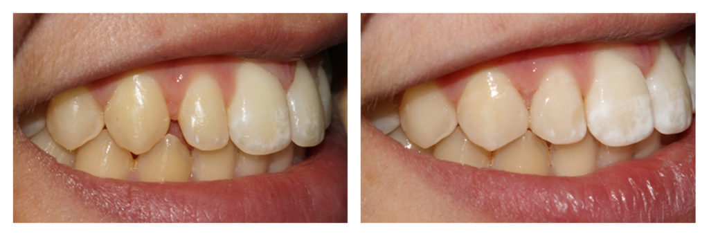 Before & After Gallery London Baker Street London