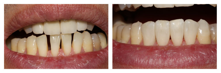 Before & After Gallery London Baker Street London