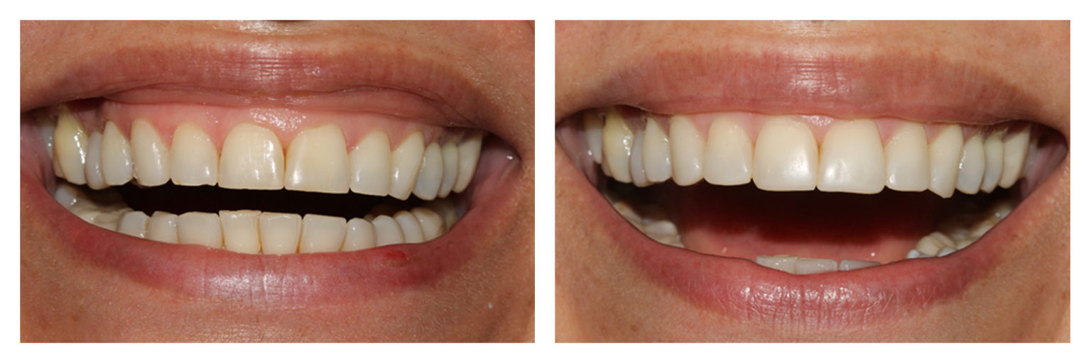 Incisal Edge Baker Street Dental
