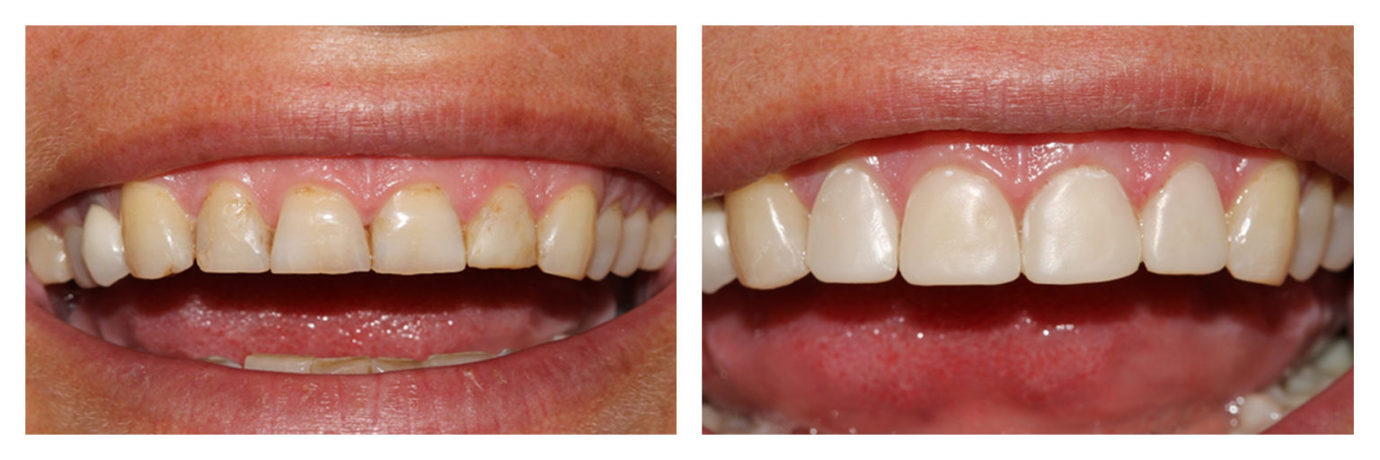 Incisal Edge Baker Street Dental