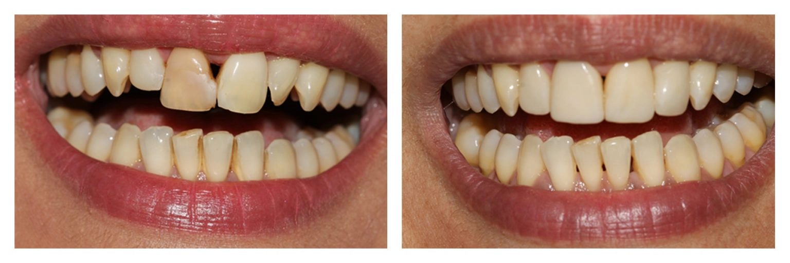 Before & After Gallery London Baker Street London