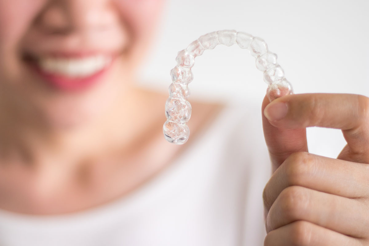 Clear braces and clear aligners, London
